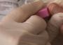 Hépatites: Médecins du monde réclame l’autorisation des tests rapides
