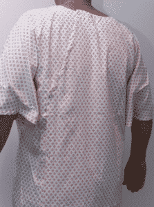 De nouvelles chemises pour les patients, respectueuses de leur pudeur