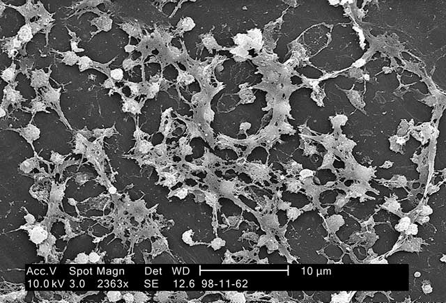 Biofilm infirmière