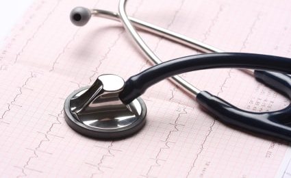 Infarctus du myocarde : Baisse de 5% à 6% par an en France