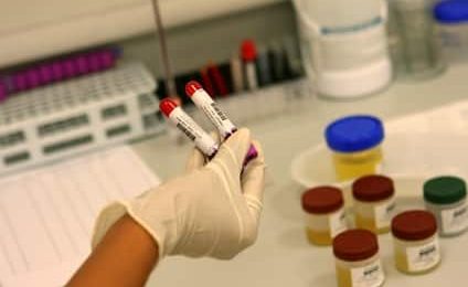 Sida: dépister 30 000 séropositifs qui s’ignorent pour endiguer l’épidémie