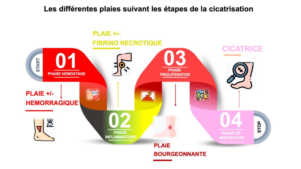 Schéma Les différentes plaies suivant les étapes de la cicatrisation