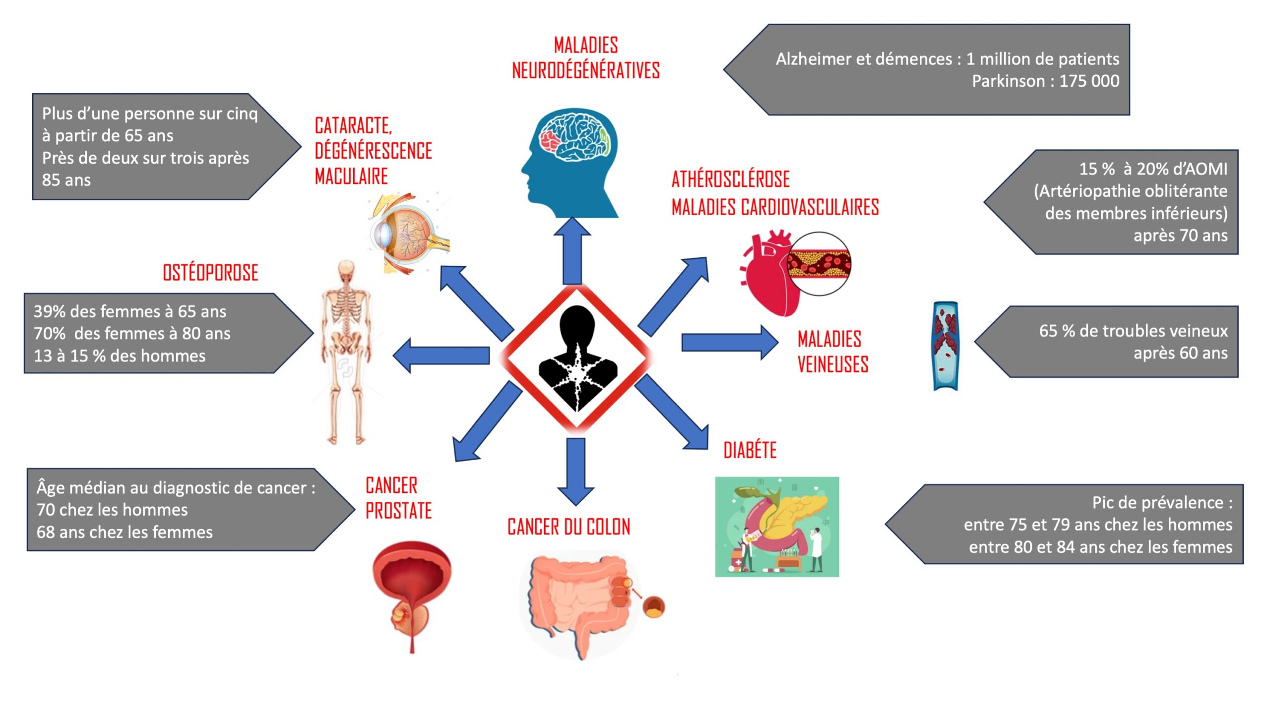 Principales pathologies chroniques chez les personnes âgées